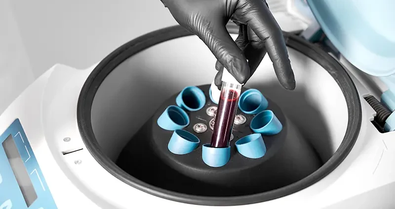 Laborator recomandari si oferte analize medicale Pitesti