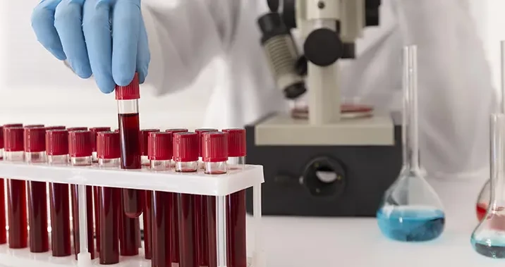 Laborator recomandari si oferte analize medicale Pitesti