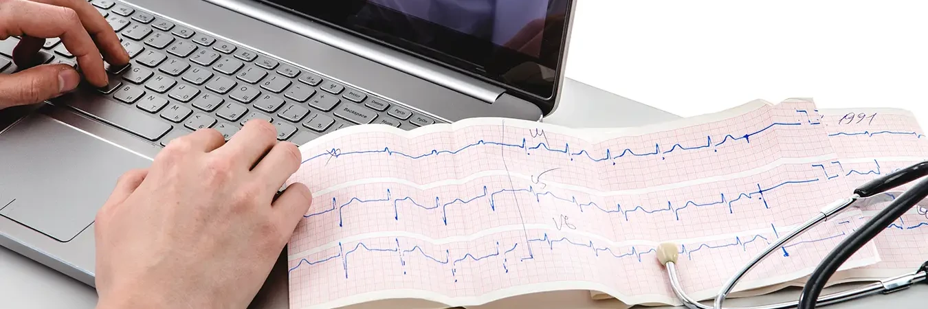 Importanta monitorizarii holter EKG