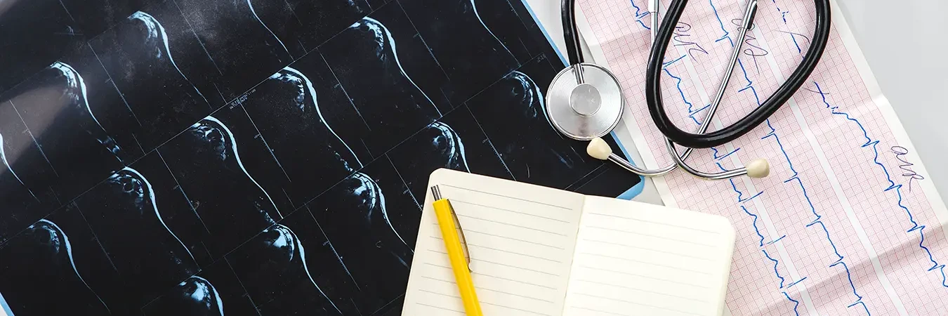 Electrocardiografii (EKG/ECG) Pitesti