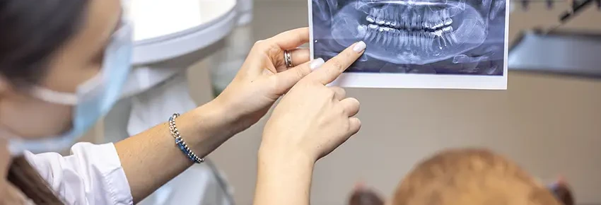 Implanturi dentare