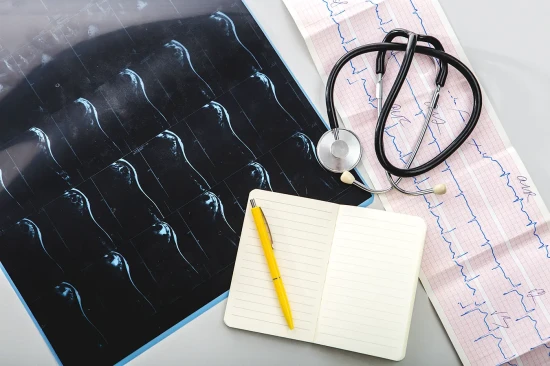 Electrocardiografii (EKG/ECG) Pitesti